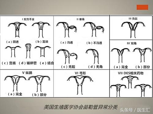 单角子宫妊娠，你遇到过吗？