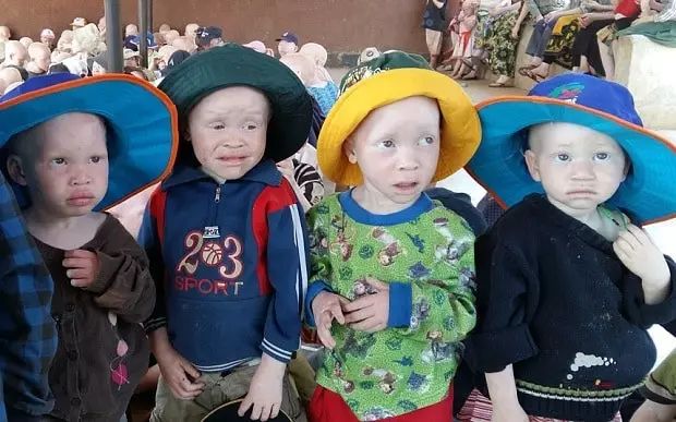 砍下白化病人的四肢入药，猎杀光头男人治病：只有你不敢想，没有巫医做不到