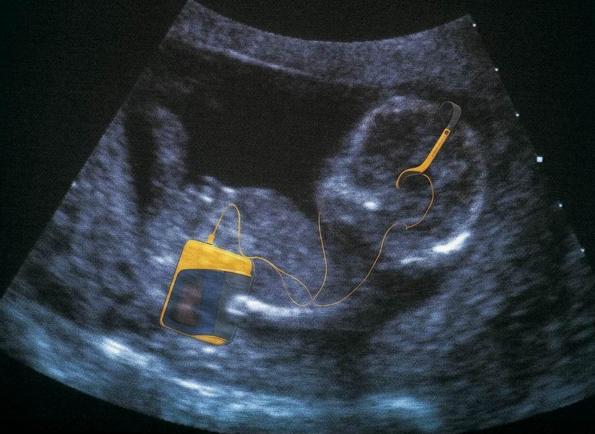 韩国孕妇可随时鉴定胎儿性别,韩国允许对胎儿进行性别鉴定