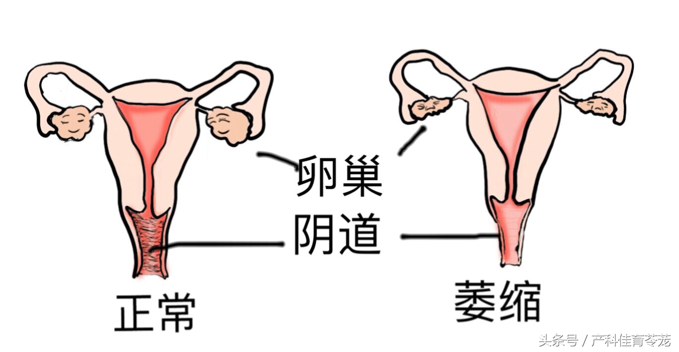 老年外阴干涩痒用药有哪些,老年人外阴瘙痒干涩咋办