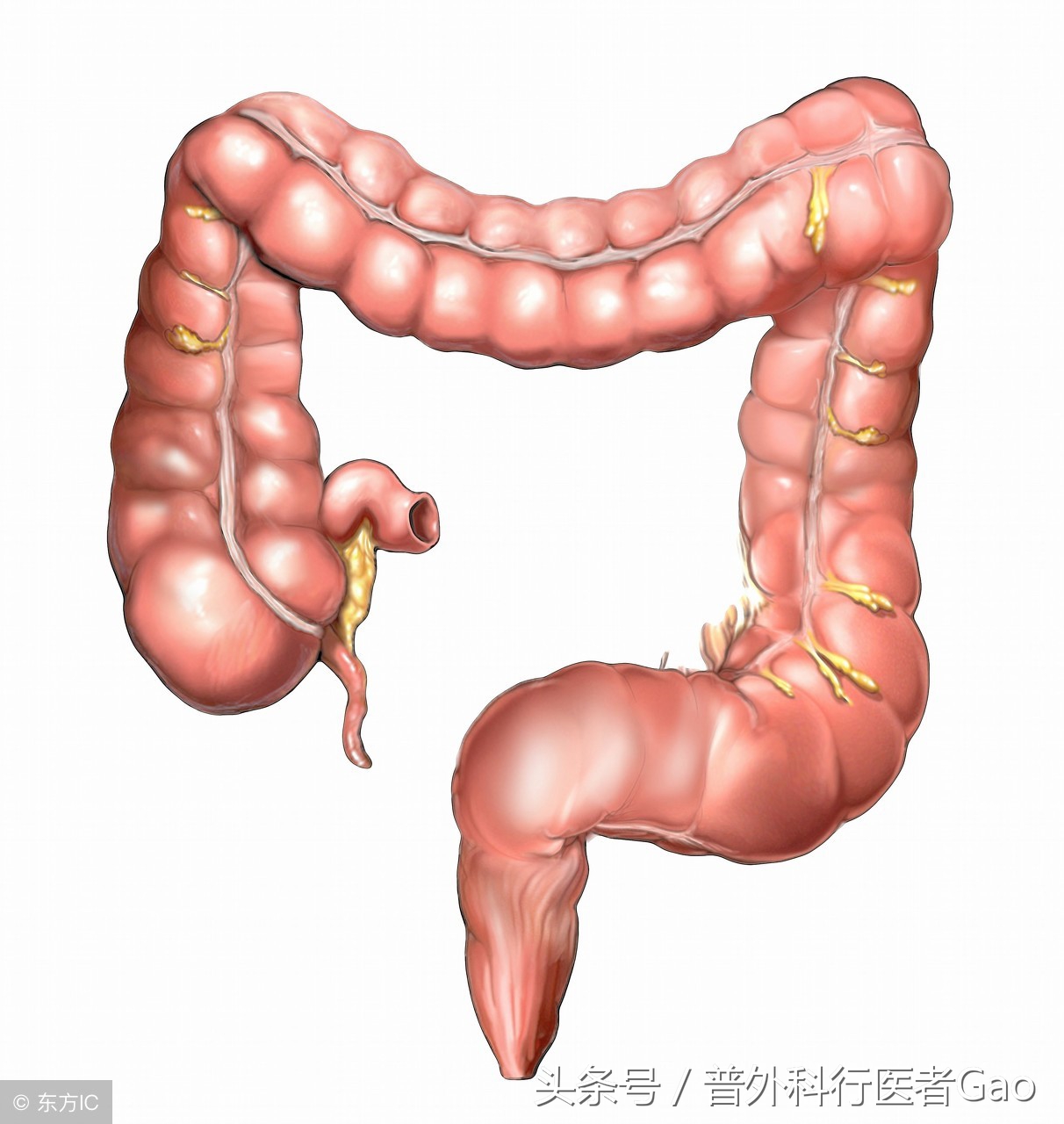 鏉忎粊鑳芥不闃戝熬鐐庡悧,鏉忎粊鍒囬櫎