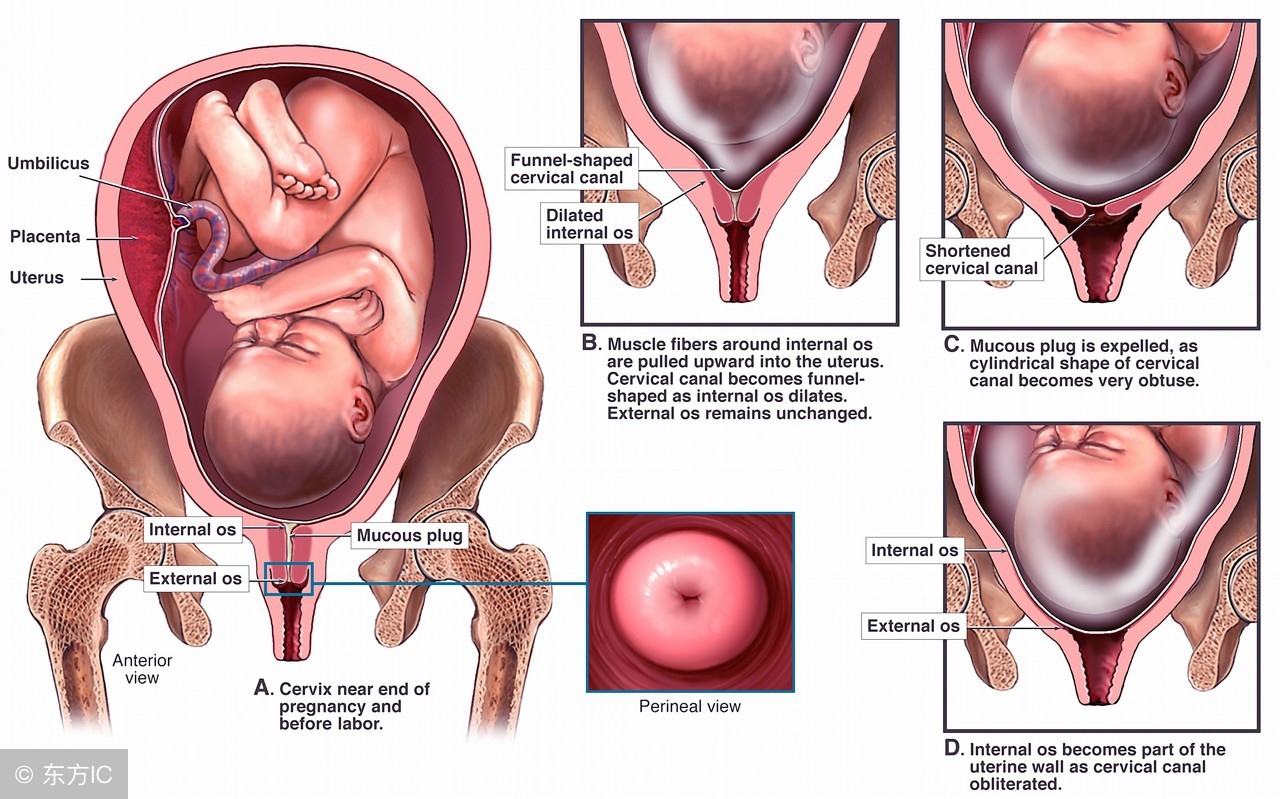 宫颈糜烂这些症状你有吗？为何会找上你？