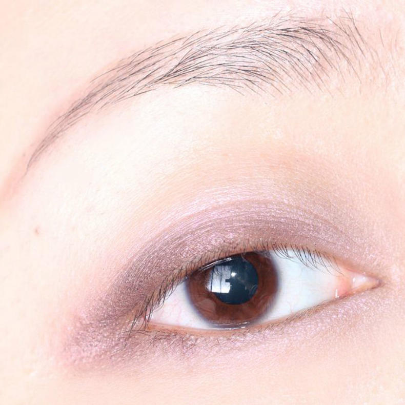 内双变外双又没了怎么办,内双变外双不复原