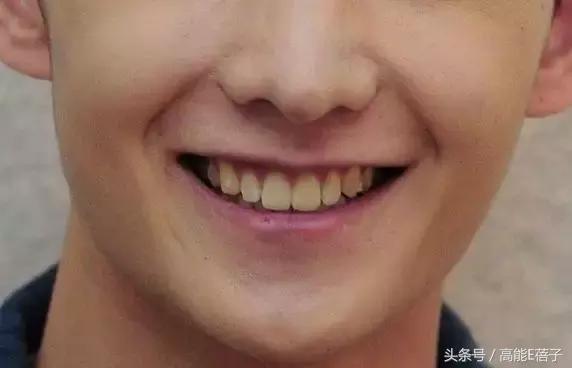 高圆圆牙齿美白,高圆圆40岁美白秘诀