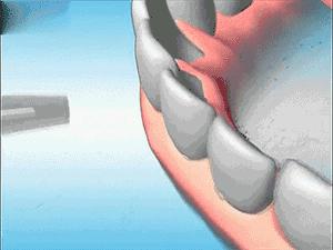 高圆圆牙齿美白,高圆圆40岁美白秘诀