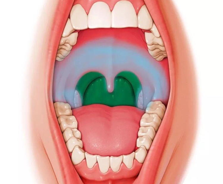 小孩嘴唇鹅口疮什么样,小孩长鹅口疮是缺维生素多少