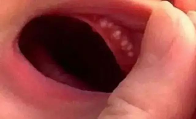 宝宝出生后遇到这种情况不用怕，儿科医生告诉你怎么应对系列3？