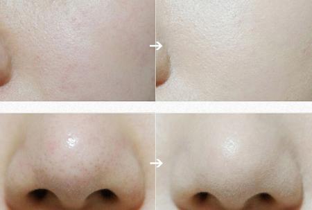 油皮必入的大牌精华,油皮bb霜好用排行榜推荐女