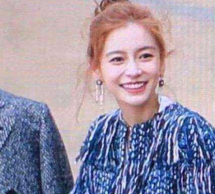 高圆圆戴牙套前后对比,高圆圆牙齿矫正牙套戴了几年