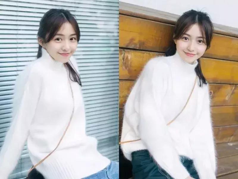 免费分享一个拯救发际线的方法,权威专家教你拯救发际线