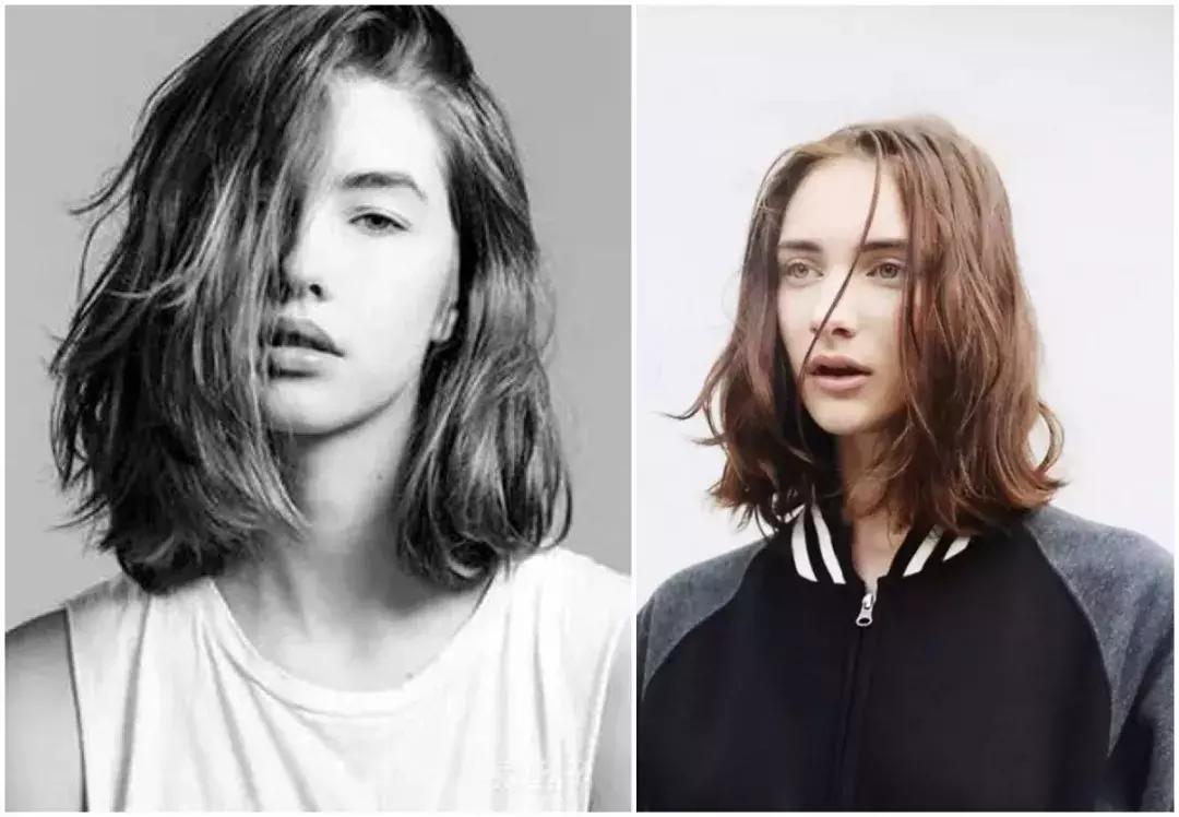 免费分享一个拯救发际线的方法,权威专家教你拯救发际线