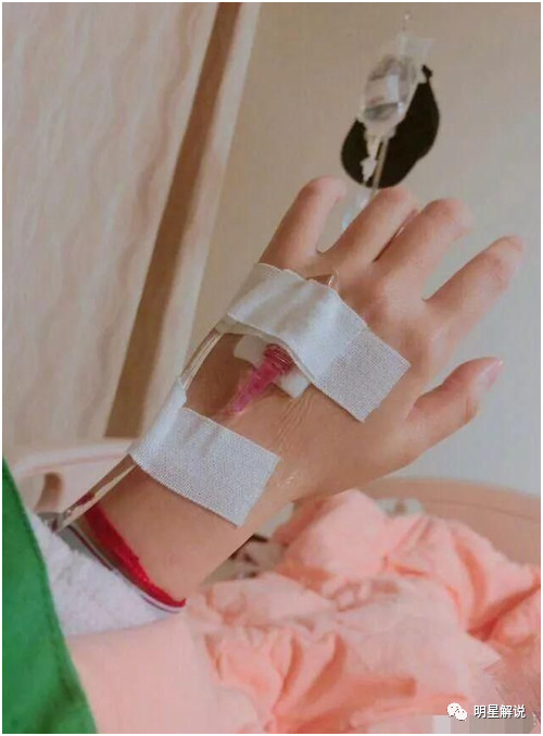 安以轩否认宫外孕,怕失人气,术后四天即参加活动面容憔悴!