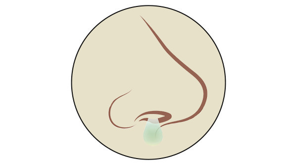 流不同颜色的鼻涕代表什么,鼻子有浓稠黄鼻涕是什么原因