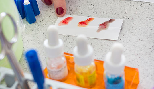 基因的奥秘和秘密,溶血是因为宝宝和父亲血型一样吗