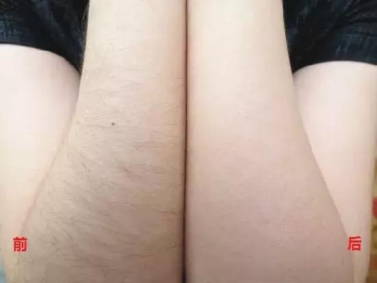 一秒脱毛,如何在一分钟内脱毛