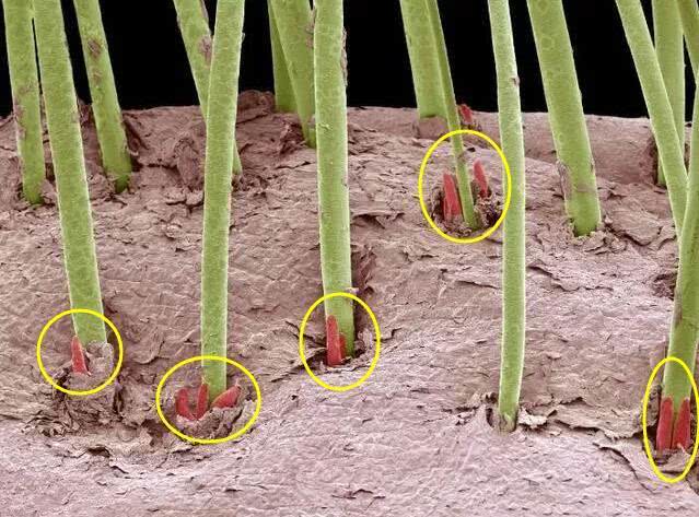 后背螨虫怎么消灭,去后背螨虫最好的方法