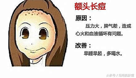 35岁女性脸上反复长痘痘怎么调理,下巴长满痘痘是什么原因怎么调理