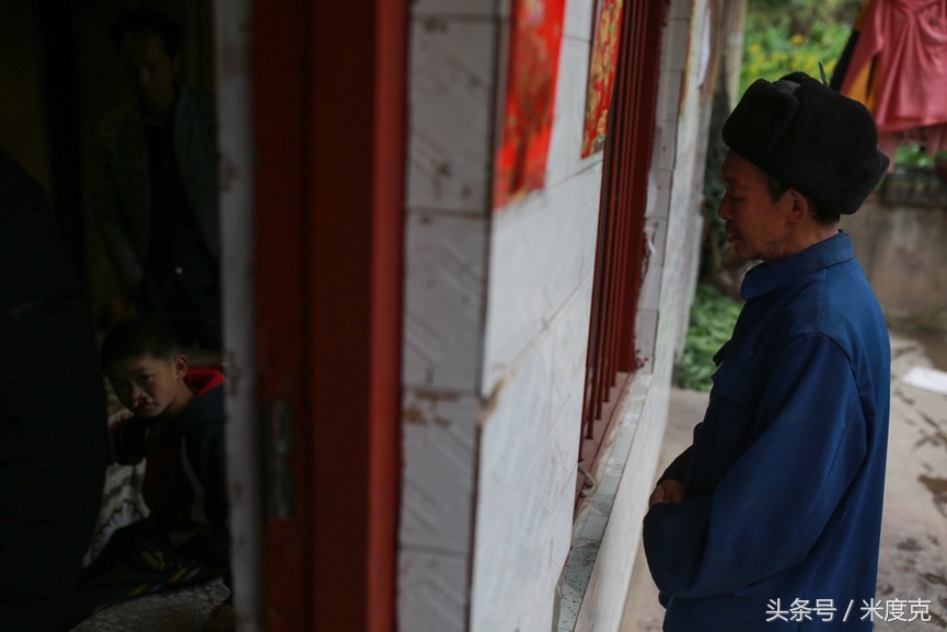 唇腭裂变帅,变帅的孩子