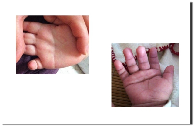 不懂中医怎么看手相,会得大病的手相掌纹