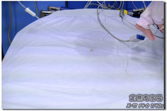 会得大病的手相掌纹,不懂中医怎么看手相