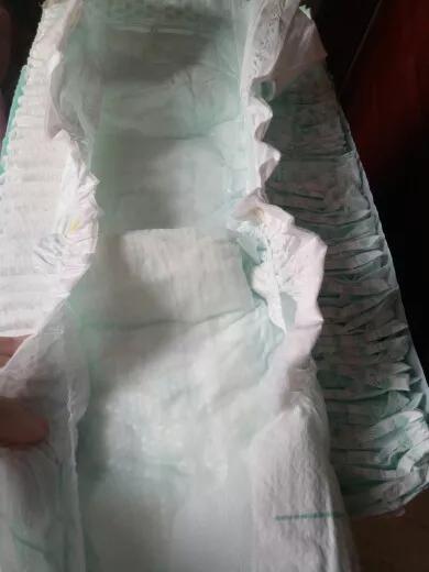 宝宝红屁屁和屁股湿疹区别,宝宝起湿疹跟纸尿裤有关系么