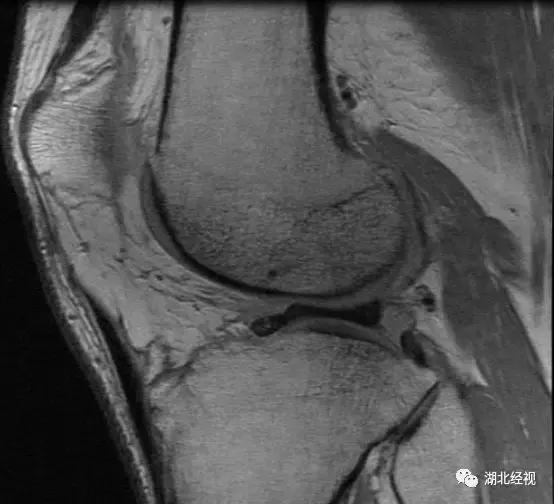 明星们钟爱的暴汗服,暴汗服可以让你肌肉变干吗