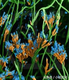 ivd基础知识大全,真菌检测要点