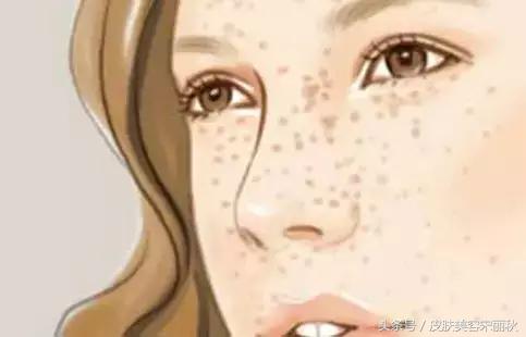 皮肤美容春夏秋冬护理方案,宋丽秋激光祛斑