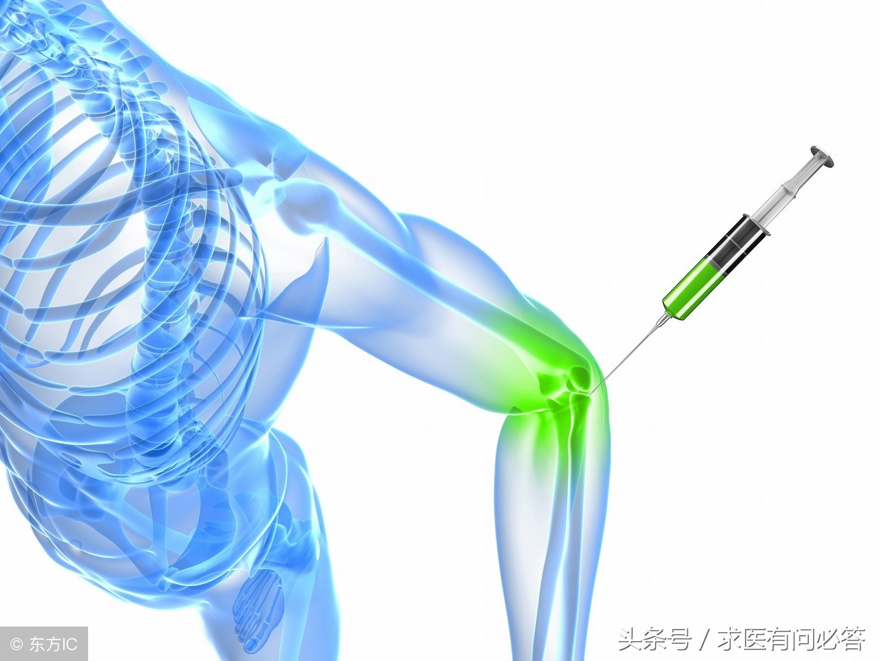 滑膜炎饮食上需要注意什么,关节炎和滑膜炎饮食吃什么好