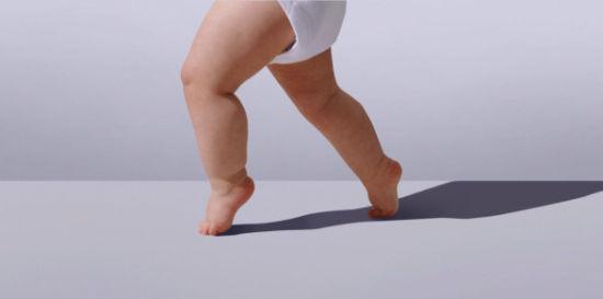 儿童走路八字脚怎么办矫正,儿童八字脚如何矫正走路姿势