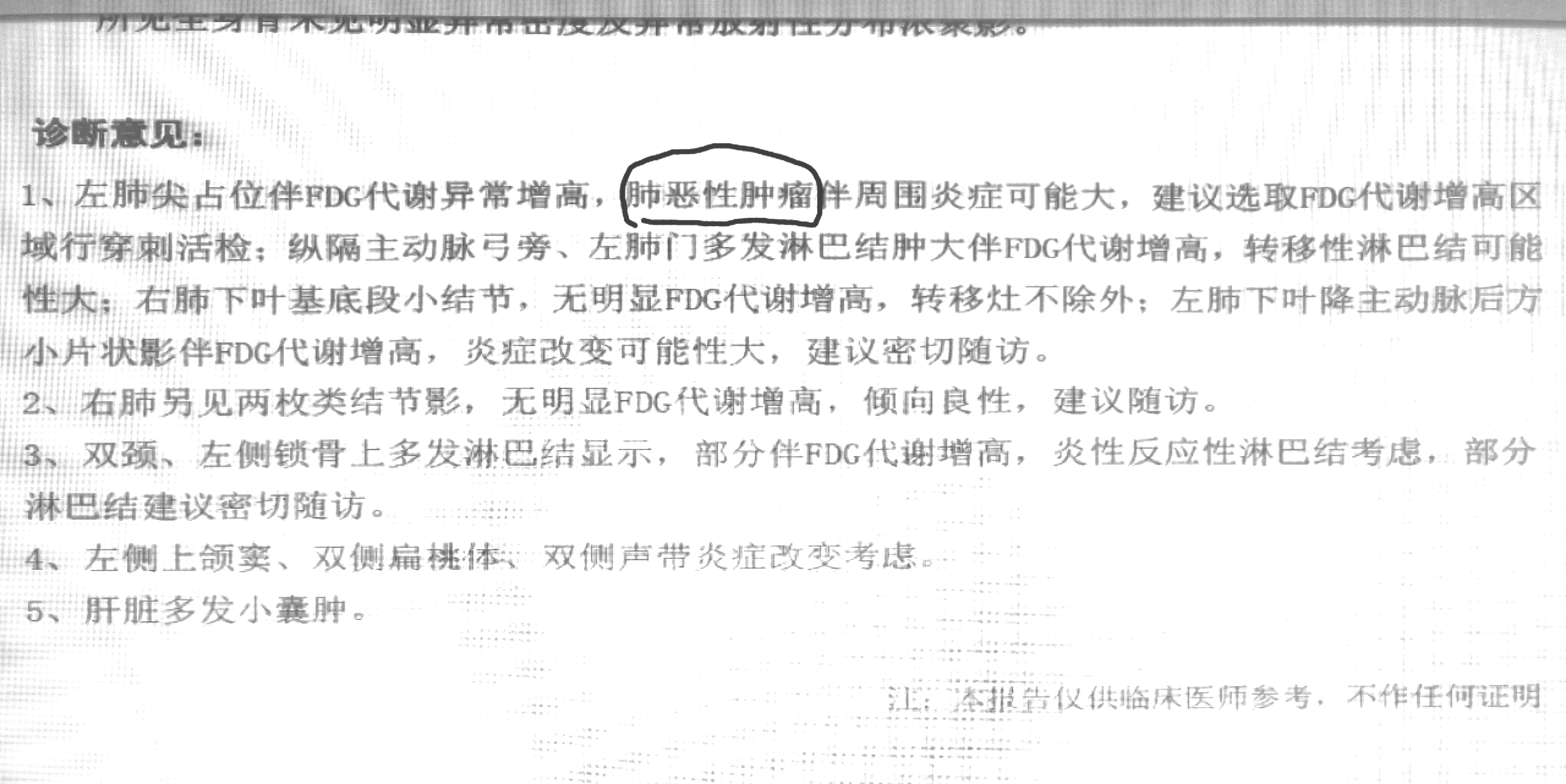 petct诊断癌症有误诊吗,petct提示癌就是癌了吗