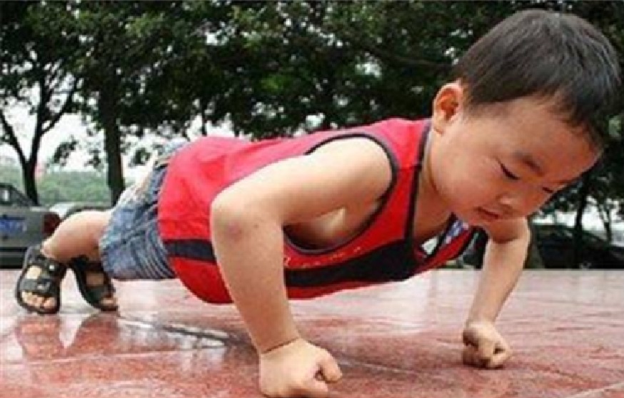 鸡胸畸形怎么矫正,18岁了鸡胸还能矫正么