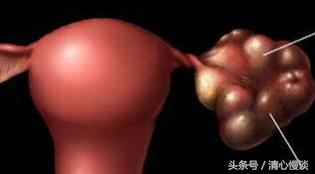 月经期间跑步卵泡破裂,大姨妈期间跑步黄体会破裂吗