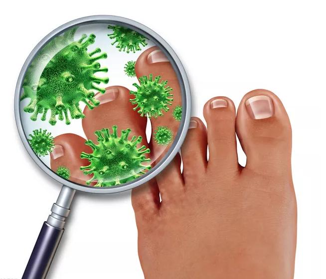 脚气是因为缺乏维生素b12,脚气病患者如何补充维生素b1