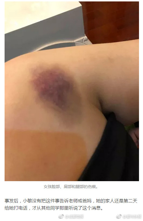 17岁女生因打呼噜，被8个女同学从上铺拖下来打！