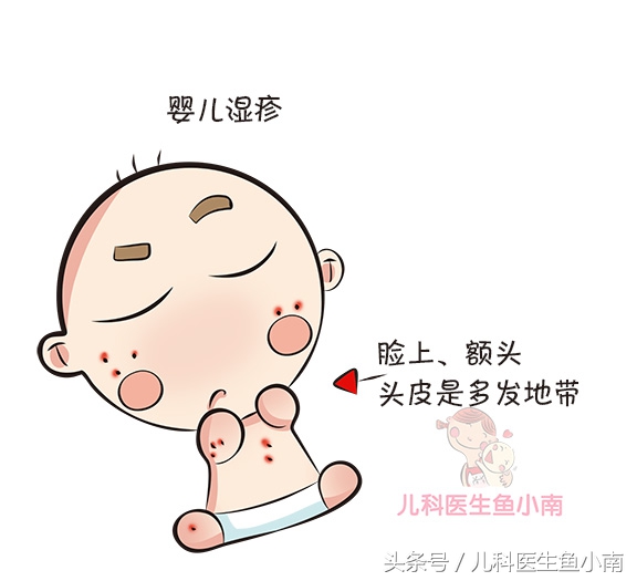 新生儿热疹和湿疹的预防与护理,宝宝湿疹热疹如何预防及护理