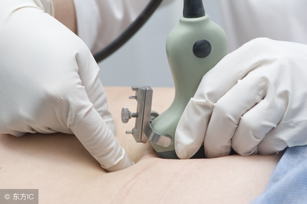 羊水穿刺21周还需要做羊穿吗,羊穿和羊水穿刺是同一个意思吗