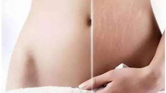 产后恢复必备十大宝典,美丽妈妈产后恢复的手法