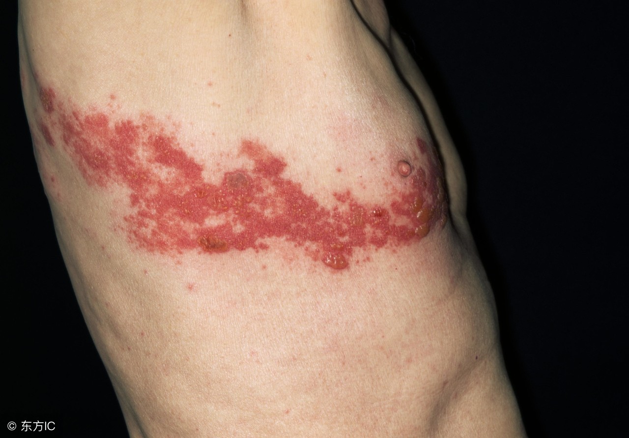 小心被藤蔓缠住,缠腰龙缠到什么地方就危险了