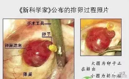 骗女生上床还买卖女生卵子，这些卖卵中介去死吧！