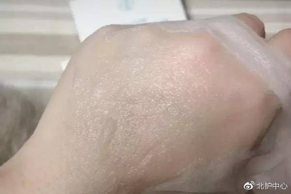 医美面膜到底值不值得购买,风很大的医美