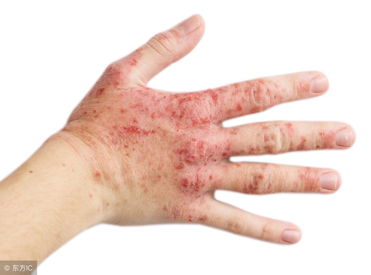 传播正能量算不算盗用,游泳池里的水会传染乙肝吗