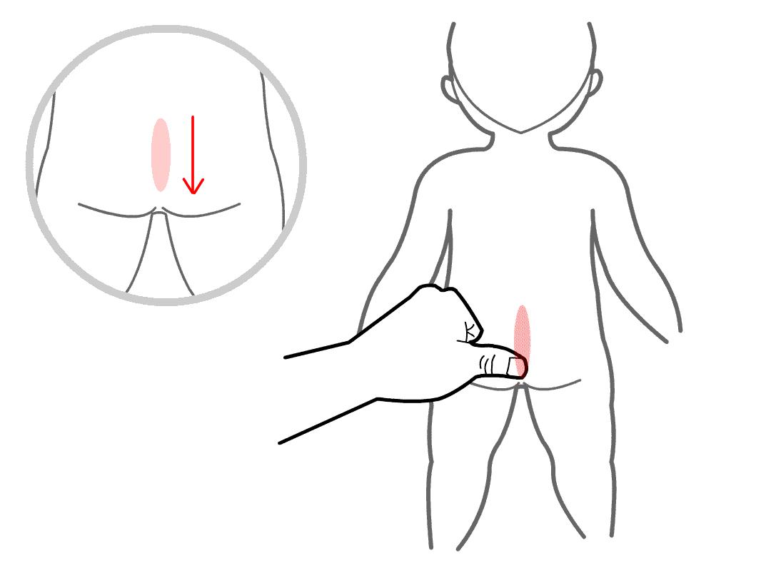 小儿湿热泄泻小儿推拿案例分析,肝胆湿热小儿推拿都用什么手法