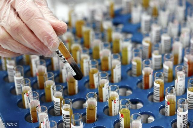 胆红素也是转氨酶吗,胆红素跟肝有关吗