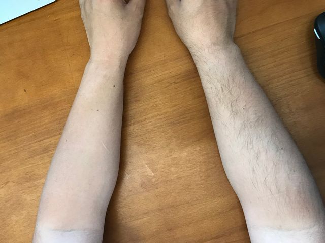 除毛膏永久去除,彻底去除毛根的脱毛膏