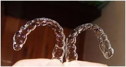 隐形牙套只需要戴32副,隐形牙套免费试戴要带回家吗