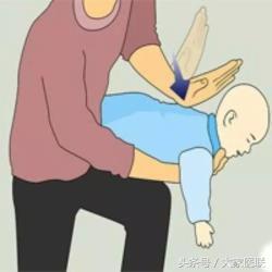 如果孩子呛到了应该怎么办,小孩呛到怎么办