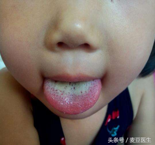 最全中医舌诊图谱来啦!看舌头,知全身!