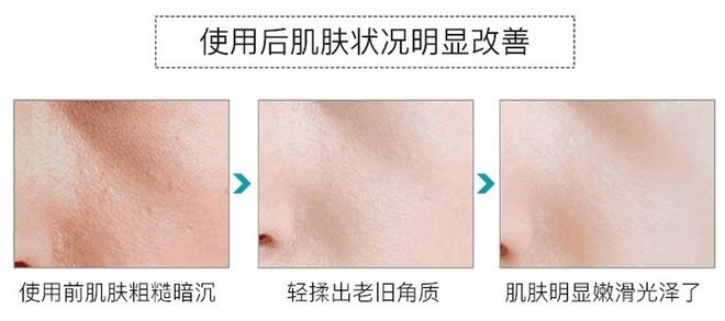 轻轻抹一抹皮肤越来越好,轻轻擦到皮肤就留下黑印子