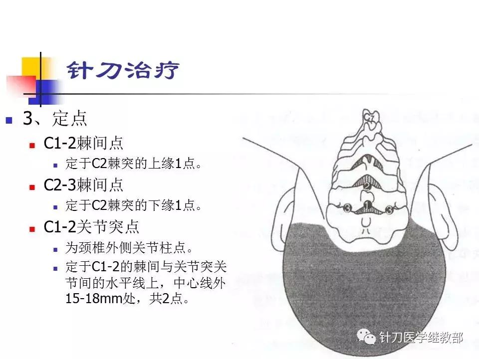 椎动脉型颈椎病错位了怎么治疗,颈椎寰枢关节错位复位手法